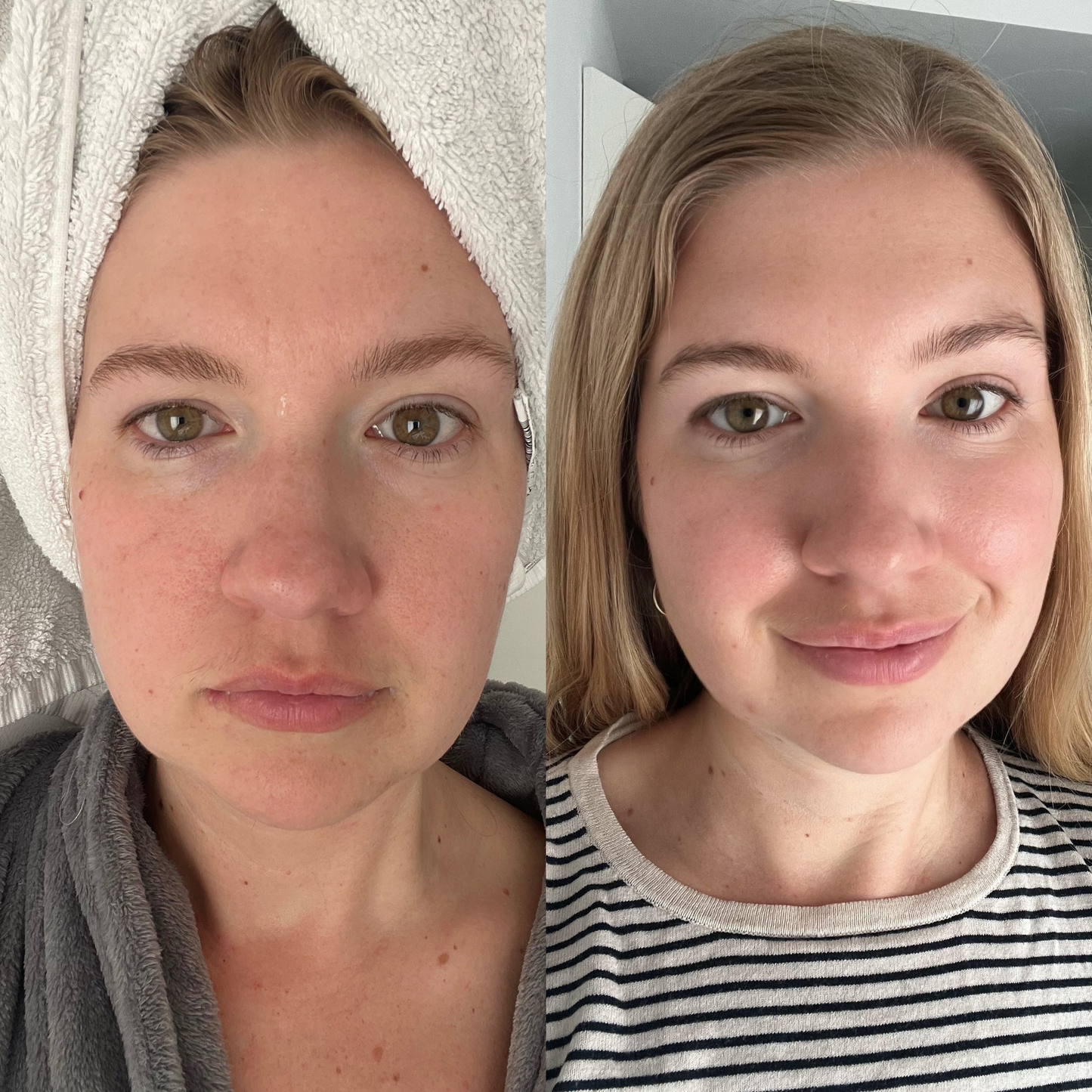Maralie Glow Goals Colágeno Marino Hidrolizado (30 sobres)
